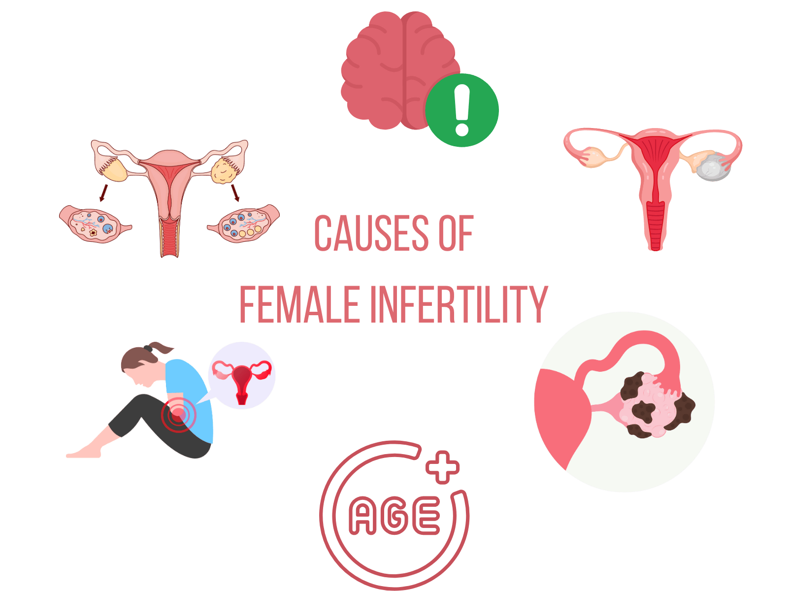 Cause of female infertility